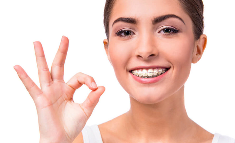 The Pros and Cons of Ceramic Braces - Elegant Dental Care